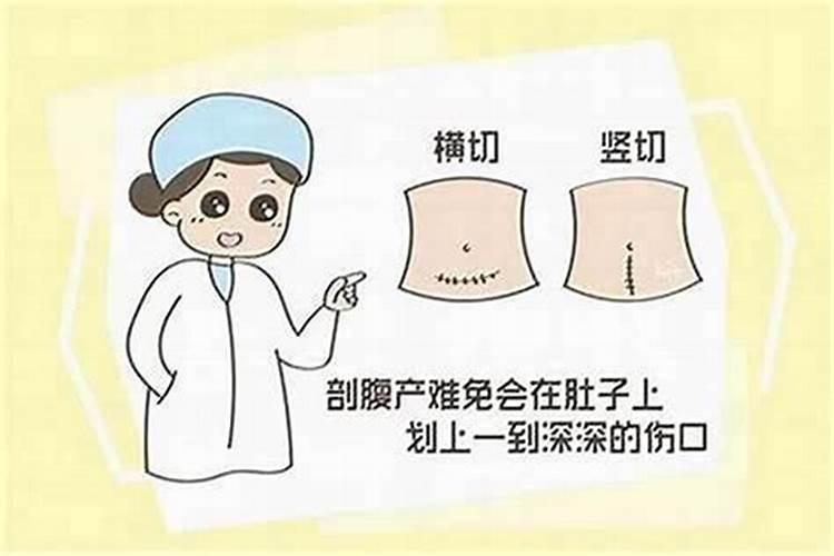 剖腹产命理准吗