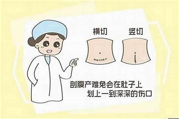 剖腹产命格准吗