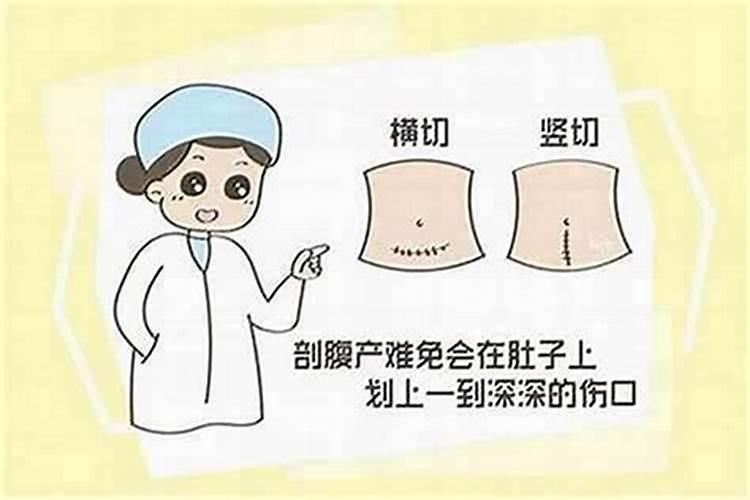 剖腹产八字准不准实例