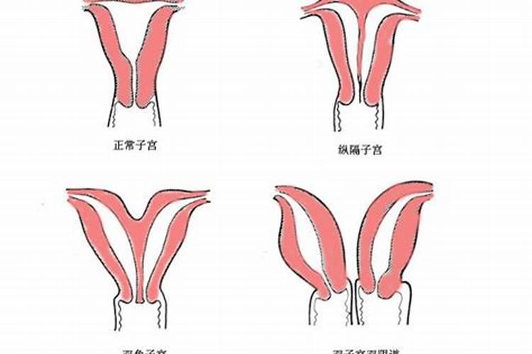 双子是什么意思