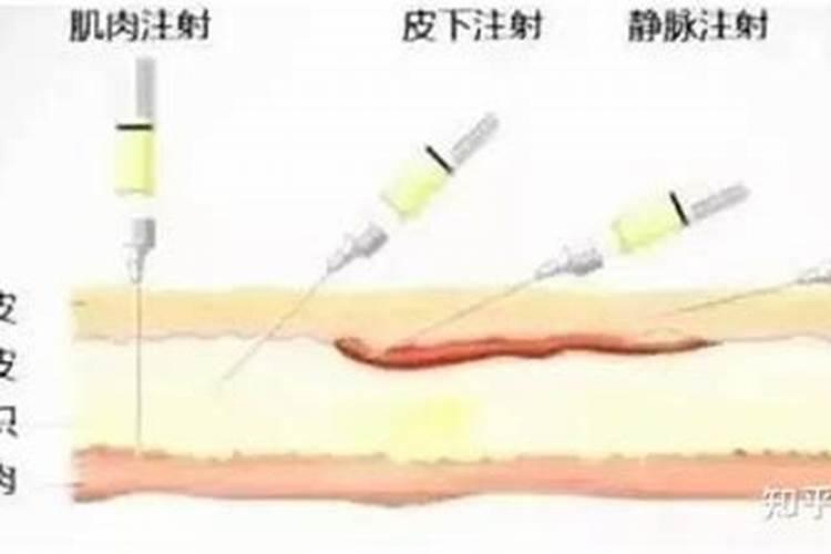 梦见手背上扎针输液